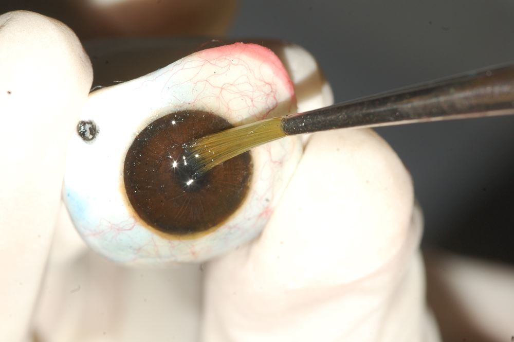 Orbit, Oculoplasty, Prosthetics & Oncology