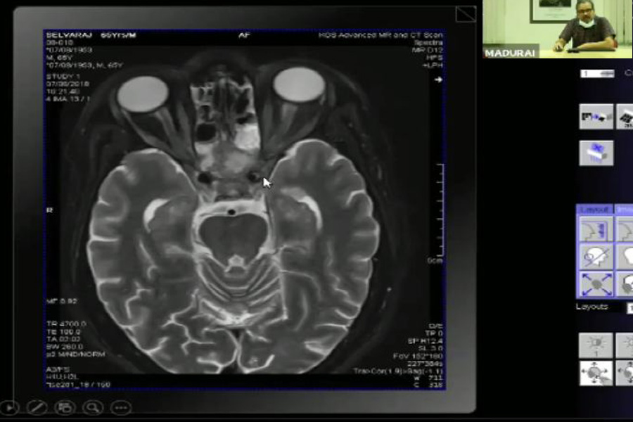 TVLWebinar2
